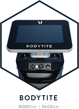 BodyTite: radiofrecuencia interna para eliminar la flacidez corporal y facial sin cicatrices